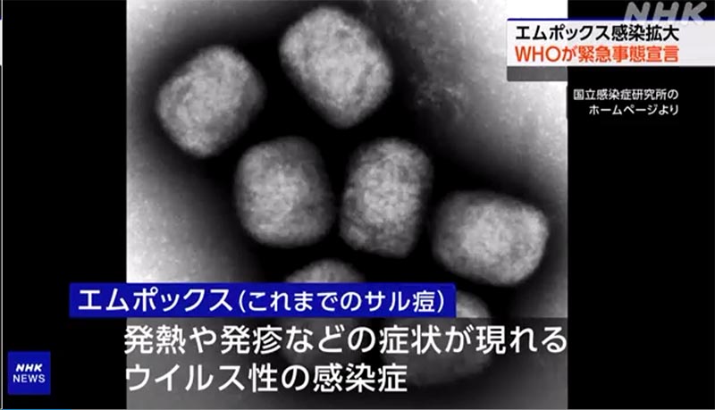 WHOエムボックスで世界的緊急事態宣言